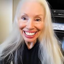 Stepmom steals $5,000 from college fund for veneers