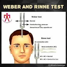 Image result for Tuning Fork Test