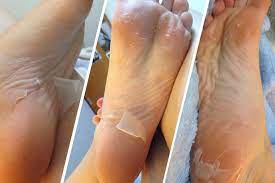 Tfs Reviews Japanese Baby Foot Peel Photos