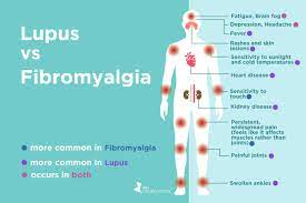 It uses a needle hooked up to small wires. Fibromyalgia Vs Lupus What S The Difference