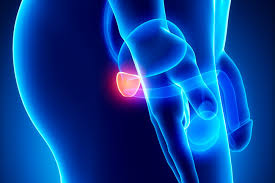 Pain in the hips, back (spine), chest (ribs), or other areas from cancer that has spread to bones. Presence Of P Acnes In Prostate Tissue Associated With Prostate Cancer Cancer Therapy Advisor