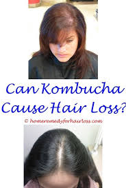 Hair Loss Losing Weight And Hair Loss Tea Tree Essential Oil For Hair Loss Hair Loss How To Stop Hai Hair Loss Remedies Vitamins For Hair Loss Help Hair Loss