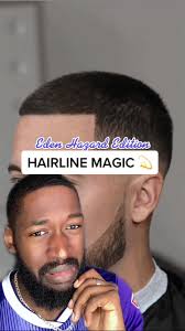 Eden Hazard Hairline Restoration Transformation by A Star Barber