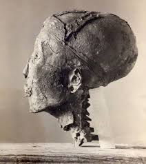Ancient Wonders of Archaeology, History & Mysteries Civilizations - The head of King Tutankhamun was cut off from the body in order to remove the famed death mask, which had attached to