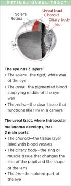 Don't ignore skin cancer signs Intraocular Melanoma The American Society Of Retina Specialists