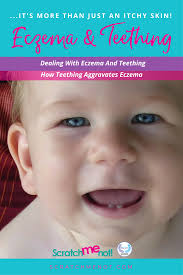 Learn how to tell if your baby has eczema, what causes eczema in babies, and how is eczema treated in babies? Eczema And Teething Not Just Itchy Skin