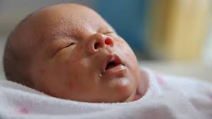 Muka bayi baru lahir merah. Masalah Kulit Pada Bayi Baru Lahir Parents Wajib Tahu Agar Tidak Khawatir