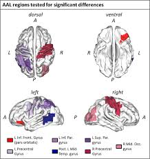 Apr 07, 2013 · april 7, 2013 a ridge within the brain's frontal lobe, just anterior to the central sulcus, which is vital for motor control, being the location of the motor area. Dissociable Electrophysiological Correlates Of Semantic Access Of Motor And Non Motor Concepts Scientific Reports