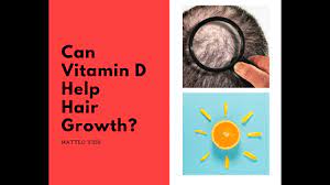 Milk, oranges and orange juice and potatoes vitamin d: Can Vitamin D Help Hair Growth Here Is My Answer Day 7 Journey To Hair Regrowth Youtube