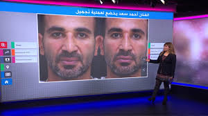 اغانى احمد سعد , البومات احمد سعد , استماع اغانى احمد سعد mp3 مجانا. ÙƒÙŠÙ ÙŠØ¨Ø¯Ùˆ Ø§Ù„ÙÙ†Ø§Ù† Ø§Ù„Ù…ØµØ±ÙŠ Ø£Ø­Ù…Ø¯ Ø³Ø¹Ø¯ Ø¨Ø¹Ø¯ Ø¹Ù…Ù„ÙŠØ© Ù†Ø­Øª Ø§Ù„ÙˆØ¬Ù‡ Youtube