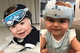 This Woman Turns Children S Medical Helmets Into Works Of Art Baby Helmet Cranial Helmet Designs Girl Baby Helmet Design