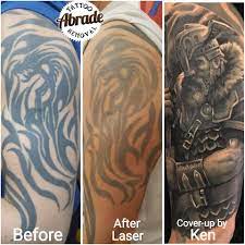 We'll go over how each removal. Another Solution To 90s Tribal Abrade Tattoo Removal Facebook