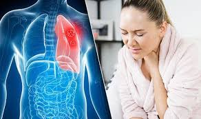 Later, it often causes coughing, wheezing, and chest pain. Lung Cancer Symptoms Signs Of Tumour Include Cough And Sore Throat Express Co Uk