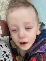 Medical-ish update ;)) Lane is still home. Is he well? No. In fact, he's  never been scarier. Sure, he has moments where he laughs, kicks and plays …  he's overall a very