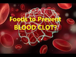 Check spelling or type a new query. 7 Foods To Prevent A Deadly Blood Clot Youtube