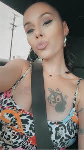 What is affected by myalgia? A. Blood B. Bones C. Muscles D. Feet