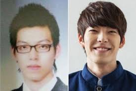 7 Artis Korea Sebelum Dan Sesudah Oplas Perubahan Dratis