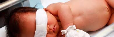 Bunda nggak perlu khawatir berlebihan ya ketika si kecilnya mengalamai penyakit bayi kuning. Cara Mengatasi Bayi Kuning Di Rumah Encikshino Com