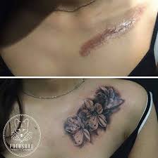 Maybe you would like to learn more about one of these? 211 Amazing Tattoos That Turn Scars Into Works Of Art Bored Panda