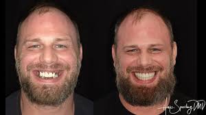 Dentist in Hollywood, FL