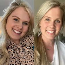 Overcoming depression and anxiety with natural products