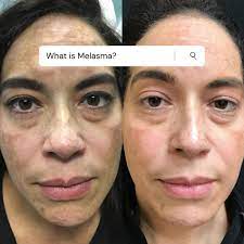 We did not find results for: Reflections The Center For Cosmetic Medicine Home Facebook
