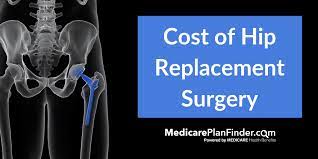 Anecdotally, i know a woman whose hip replacement surgery bill came to $102,000, so the range is wide. Scary Truth Does Medicare Cover Hip Replacement Surgery