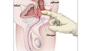 أفضل علاج مُجرب لمرض سرطان الغدد اللمفاوية بالأعشاب. Ø§Ø³ØªØ«Ù†Ø§Ø¦ÙŠ Ø§Ù„Ø£Ø¨Ø¬Ø¯ÙŠØ© Ù…Ø±Ø­Ù„Ø© Ù…Ø§ Ù‚Ø¨Ù„ Ø§Ù„Ù…Ø¯Ø±Ø³Ø© Ù…Ø§Ù‡ÙŠ Ø§Ø¹Ø±Ø§Ø¶ Ø³Ø±Ø·Ø§Ù† Ø§Ù„Ø¨Ø±ÙˆØ³ØªØ§ØªØ§ Ø¹Ù†Ø¯ Ø§Ù„Ù†Ø³Ø§Ø¡ Alterazioni Org
