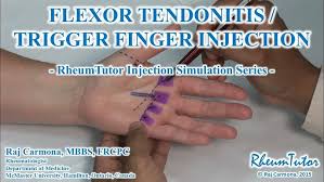 Image result for Hand Injection