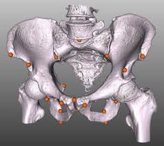 Corpus cavernosum of the penis. The Pelvis Bone Of A Ct Of The Used Data Set Is Rendered With The Download Scientific Diagram