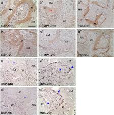 See bbb rating, reviews, complaints, & more. Cementogenic Genes In Human Periodontal Ligament Stem Cells Are Downregulated In Response To Osteogenic Stimulation While Upregulated By Vitamin C Treatment Abstract Europe Pmc