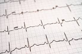 Image result for Electrocardiogram