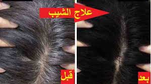تجربتي مع زيت الميرمية للشيب قبل و بعد الاستعمال