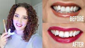 Check spelling or type a new query. Snow Teeth Whitening Review Best Teeth Whitening For Sensitive Teeth Youtube