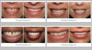Las vegas' premiere cosmetic dentistry experts. Cosmetic Dentistry Las Vegas Dental News Network