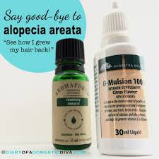 Propecia is taken in the form of tablets, one each day. Pin On Alopecia Areata Treatment