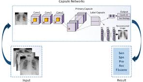New york city was the last region in the state to enter the second of the four stages in the state's reopening plan. Convolutional Capsnet A Novel Artificial Neural Network Approach To Detect Covid 19 Disease From X Ray Images Using Capsule Networks Sciencedirect