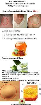 Avoid Surgery Recipe For Natural Removal Of Fatty Tissue Lipoma Natural Aloe Vera Gel Healthy Facts Surgery