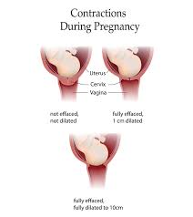 3 Types Of Contractions During Pregnancy Its Significance