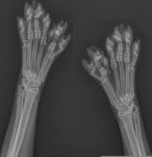 Polydactyl Cat An X Ray Of The Paws Of A Polydactyl Cat The Number Of Toes Never Polydactyl Cat Pixie Bob Cats Crazy Cats