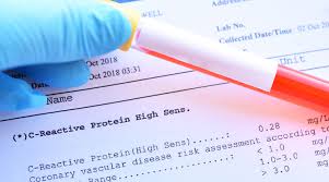 How To Lower Your C Reactive Protein Crp Levels Life Extension