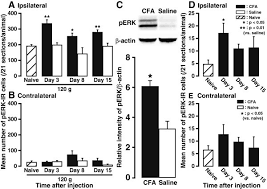 We did not find results for: Metabotropic Glutamate Receptor 5 Contributes To Inflammatory Tongue Pain Via Extracellular Signal Regulated Kinase Signaling In The Trigeminal Spinal Subnucleus Caudalis And Upper Cervical Spinal Cord Journal Of Neuroinflammation Full Text