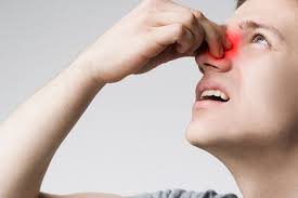 Hidung berdarah, apa yang harus saya lakukan? Waspadai Ini 5 Penyebab Mimisan Di Malam Hari Halaman All Kompas Com