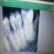 Curved root product image