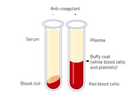 Image result for Plasma Transfusion