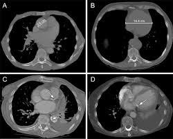Image result for Incidental Imaging Finding
