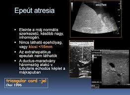 A Maj Az Epeutak Es A Pancreas Betegsegeinek Ultrahangvizsgalata Gyermekkorban Varkonyi Ildiko Semmelweis Egyetem I Pdf Free Download