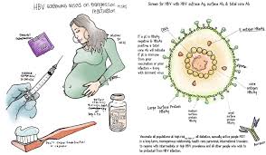 Sep 28, 2018 · what is hepatitis b? 5 Pearls On Chronic Hepatitis B Part 1 Core Im Podcast