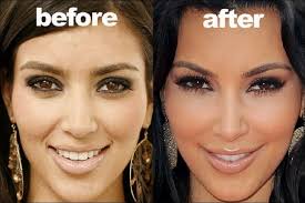 Kim kardashian zeigt sich ungeschminkt! Kim Kardashian Vorwurfe Der Plastischen Chirurgie Chirurgie Kardashian Plastisc Kardashian Plastic Surgery Celebrity Plastic Surgery Plastic Surgery Photos