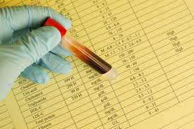 Cholesterin Senken Die Besten Tipps Und Hausmittel Heilpraxis